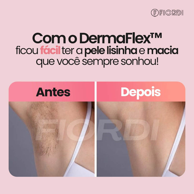 Depilador Elétrico 4 em 1 - DermaFlex® [Edição Limitada]